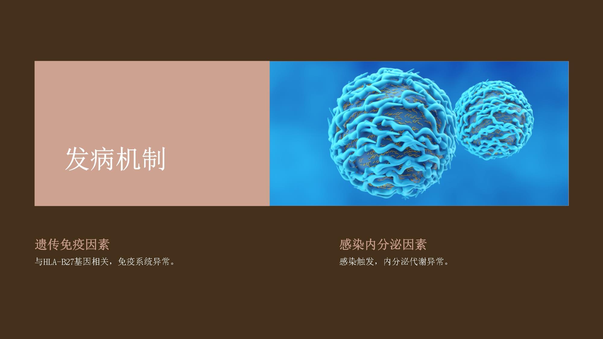 強(qiáng)直性脊柱炎 從診斷到治療的系統(tǒng)教學(xué)